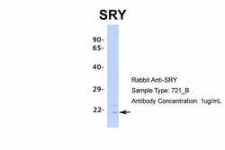 Invitrogen SRY Polyclonal Antibody 100 &mu;L; Unconjugated:Antibodies,