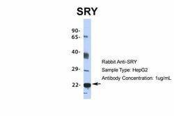 Invitrogen SRY Polyclonal Antibody 100 &mu;L; Unconjugated:Antibodies,