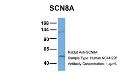 Invitrogen SCN8A Polyclonal Antibody 100 &mu;L | Buy Online | Invitrogen&trade; | Fisher Scientific