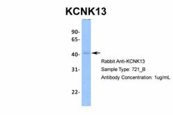 Invitrogen KCNK13 Polyclonal Antibody 100 &mu;L; Unconjugated:Antibodies,