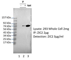 ZIC2 Polyclonal Antibody:Antibodies, Polyclonal