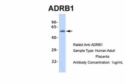 Invitrogen beta-1 Adrenergic Receptor Polyclonal Antibody 100 &mu;L; Unconjugated:Antibodies,