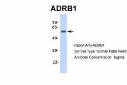 Invitrogen beta-1 Adrenergic Receptor Polyclonal Antibody 100 &mu;L; Unconjugated:Antibodies,