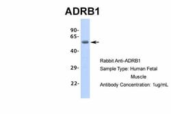 Invitrogen beta-1 Adrenergic Receptor Polyclonal Antibody 100 &mu;L; Unconjugated:Antibodies,