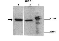 Invitrogen beta-1 Adrenergic Receptor Polyclonal Antibody 100 &mu;L; Unconjugated:Antibodies,