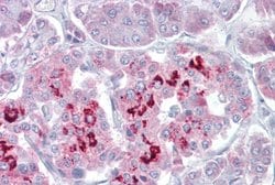 Invitrogen SIM1 Polyclonal Antibody 100 &mu;L; Unconjugated:Antibodies,