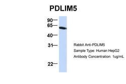 Invitrogen PDLIM5 Polyclonal Antibody 100 &mu;L; Unconjugated:Antibodies,