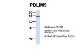Invitrogen PDLIM5 Polyclonal Antibody 100 &mu;L; Unconjugated:Antibodies,