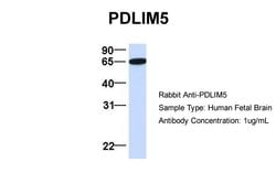 Invitrogen PDLIM5 Polyclonal Antibody 100 &mu;L; Unconjugated:Antibodies,