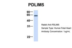 Invitrogen PDLIM5 Polyclonal Antibody 100 &mu;L; Unconjugated:Antibodies,