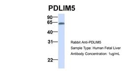 Invitrogen PDLIM5 Polyclonal Antibody 100 &mu;L; Unconjugated:Antibodies,