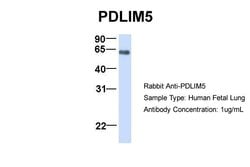 Invitrogen PDLIM5 Polyclonal Antibody 100 &mu;L; Unconjugated:Antibodies,