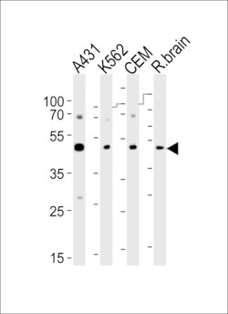 Invitrogen SUV39H2 Polyclonal Antibody 400 μL; Unconjugated:Antibodies,