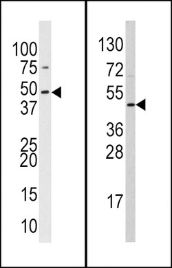 Invitrogen SUV39H2 Polyclonal Antibody 400 μL; Unconjugated:Antibodies,