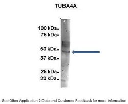Invitrogen TUBA4A Polyclonal Antibody 100 μL; Unconjugated:Antibodies,
