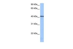Invitrogen APOBEC3F Polyclonal Antibody 100 μL; Unconjugated:Antibodies,