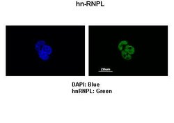 Invitrogen hnRNP L Polyclonal Antibody 100 &mu;L; Unconjugated:Antibodies,