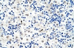 Invitrogen hnRNP L Polyclonal Antibody 100 &mu;L; Unconjugated:Antibodies,