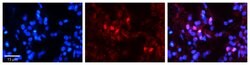 Invitrogen SNRNP70 Polyclonal Antibody 100 &mu;L | Buy Online | Invitrogen&trade; | Fisher Scientific