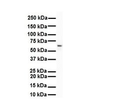 Invitrogen SNRNP70 Polyclonal Antibody 100 &mu;L | Buy Online | Invitrogen&trade; | Fisher Scientific