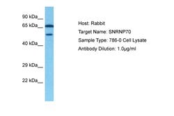 Invitrogen SNRNP70 Polyclonal Antibody 100 &mu;L | Buy Online | Invitrogen&trade; | Fisher Scientific
