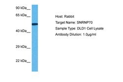 Invitrogen SNRNP70 Polyclonal Antibody 100 &mu;L | Buy Online | Invitrogen&trade; | Fisher Scientific
