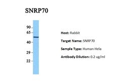 Invitrogen SNRNP70 Polyclonal Antibody 100 &mu;L | Buy Online | Invitrogen&trade; | Fisher Scientific