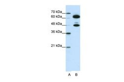 Invitrogen SNRNP70 Polyclonal Antibody 100 &mu;L | Buy Online | Invitrogen&trade; | Fisher Scientific