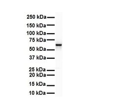 Invitrogen SNRNP70 Polyclonal Antibody 100 &mu;L | Buy Online | Invitrogen&trade; | Fisher Scientific