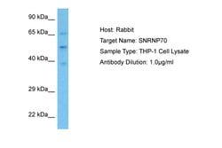 Invitrogen SNRNP70 Polyclonal Antibody 100 &mu;L | Buy Online | Invitrogen&trade; | Fisher Scientific
