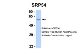 Invitrogen SRP54 Polyclonal Antibody 100 &mu;L | Buy Online | Invitrogen&trade; | Fisher Scientific