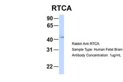 Invitrogen RTCA Polyclonal Antibody 100 &mu;L; Unconjugated:Antibodies,