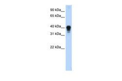 Invitrogen TIA-1 Polyclonal Antibody 100 &mu;L; Unconjugated:Antibodies,