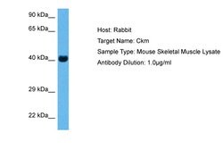 Invitrogen Creatine Kinase MB Polyclonal Antibody 100 &mu;L; Unconjugated:Antibodies,