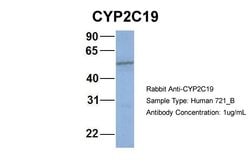 Invitrogen CYP2C19 Polyclonal Antibody 100 &mu;L; Unconjugated:Antibodies,