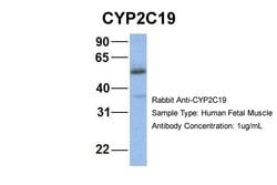 Invitrogen CYP2C19 Polyclonal Antibody 100 &mu;L; Unconjugated:Antibodies,