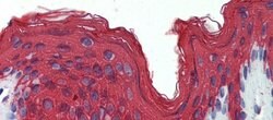 Invitrogen Cytokeratin 1 Polyclonal Antibody 100 μL; Unconjugated:Antibodies,