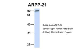 Invitrogen ARPP21 Polyclonal Antibody 100 &mu;L; Unconjugated:Antibodies,