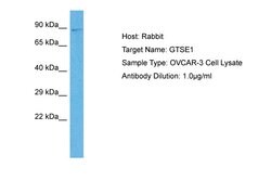 Invitrogen GTSE1 Polyclonal Antibody 100 &mu;L; Unconjugated:Antibodies,