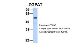Invitrogen ZGPAT Polyclonal Antibody 100 &mu;L; Unconjugated:Antibodies,