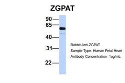 Invitrogen ZGPAT Polyclonal Antibody 100 &mu;L; Unconjugated:Antibodies,