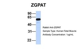 Invitrogen ZGPAT Polyclonal Antibody 100 &mu;L; Unconjugated:Antibodies,