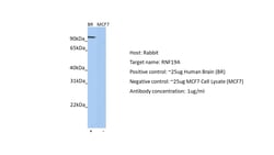 Invitrogen RNF19A Polyclonal Antibody 100 μL; Unconjugated:Antibodies,
