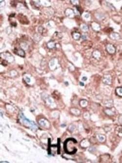 Invitrogen BAK Polyclonal Antibody 400 &mu;L; Unconjugated:Antibodies,