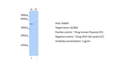 Invitrogen SLC8B1 Polyclonal Antibody 100 &mu;L; Unconjugated:Antibodies,