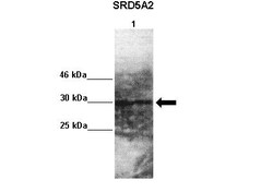 Invitrogen SRD5A2 Polyclonal Antibody 100 &mu;L; Unconjugated:Antibodies,