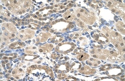Invitrogen PSEN2 Polyclonal Antibody 100 &mu;L; Unconjugated:Antibodies,