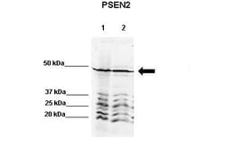 Invitrogen PSEN2 Polyclonal Antibody 100 &mu;L; Unconjugated:Antibodies,