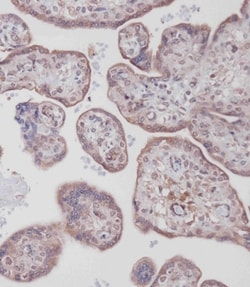 Invitrogen Bcl-2 Polyclonal Antibody 400 μL; Unconjugated:Antibodies,