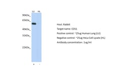 Invitrogen CDS1 Polyclonal Antibody 100 &mu;L; Unconjugated:Antibodies,